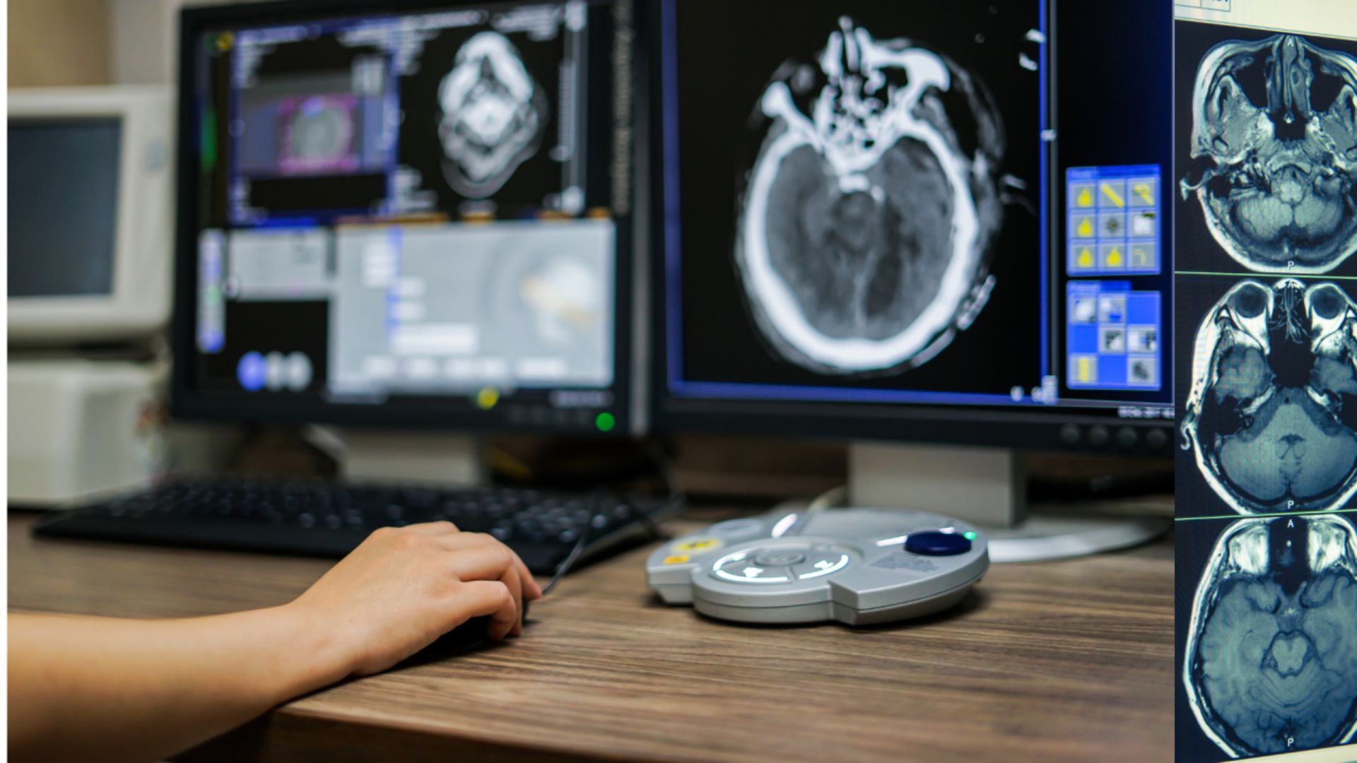 AI Diagnostics Enhancing Early Disease Detection