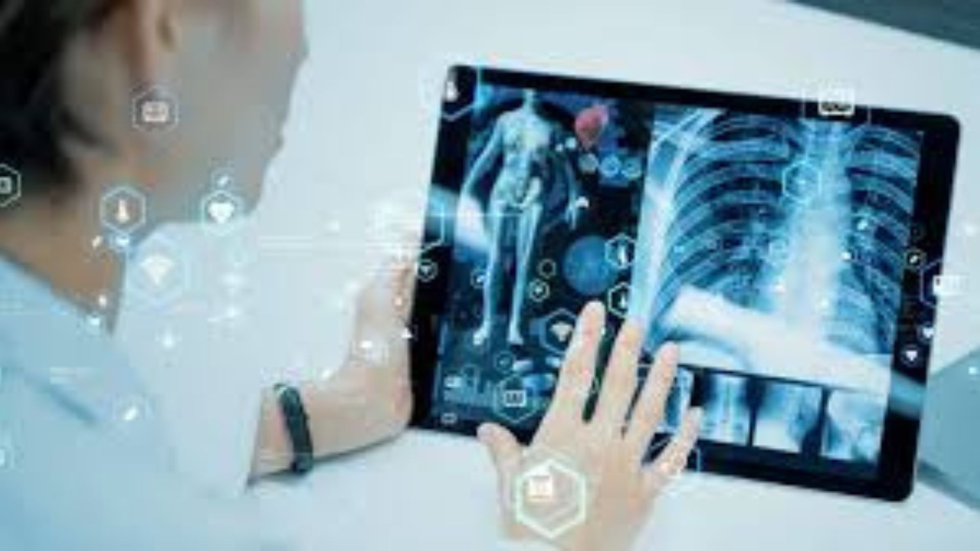 AI Helping Diagnose Rare Diseases Faster